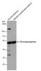 Fibrinogen Gamma Chain antibody, PA5-21968, Invitrogen Antibodies, Western Blot image 