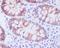 Stathmin 1 antibody, M01194, Boster Biological Technology, Immunohistochemistry frozen image 