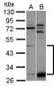 Zinc Finger Protein 410 antibody, LS-C155565, Lifespan Biosciences, Western Blot image 