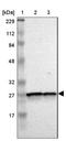 Glutathione S-Transferase Kappa 1 antibody, NBP1-89727, Novus Biologicals, Western Blot image 