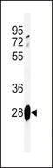 Adrenomedullin antibody, 61-752, ProSci, Western Blot image 