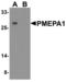 Prostate Transmembrane Protein, Androgen Induced 1 antibody, LS-C358494, Lifespan Biosciences, Western Blot image 