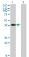 Insulin gene enhancer protein ISL-2 antibody, H00064843-M03, Novus Biologicals, Western Blot image 