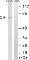 Complement component C9 antibody, A30625, Boster Biological Technology, Western Blot image 