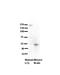 Ribosomal RNA Processing 1 antibody, 30-120, ProSci, Immunohistochemistry paraffin image 