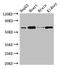 Heterogeneous Nuclear Ribonucleoprotein L antibody, CSB-PA010612LA01HU, Cusabio, Western Blot image 