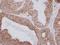 Polyribonucleotide Nucleotidyltransferase 1 antibody, LS-C186418, Lifespan Biosciences, Immunohistochemistry frozen image 