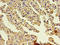 Gelsolin antibody, orb350501, Biorbyt, Immunohistochemistry paraffin image 