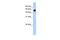 Regulator Of Microtubule Dynamics 3 antibody, PA5-43037, Invitrogen Antibodies, Western Blot image 