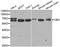 Cystathionine-Beta-Synthase antibody, STJ22918, St John