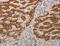 Apoptosis Inducing Factor Mitochondria Associated 1 antibody, LS-C403807, Lifespan Biosciences, Immunohistochemistry paraffin image 