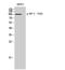 Eukaryotic Translation Elongation Factor 2 antibody, STJ91030, St John