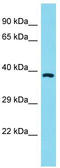 Olfactory Receptor Family 11 Subfamily A Member 1 antibody, TA331989, Origene, Western Blot image 