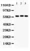 Heparanase antibody, PB9427, Boster Biological Technology, Western Blot image 