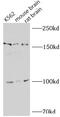NLR Family Pyrin Domain Containing 1 antibody, FNab05757, FineTest, Immunohistochemistry paraffin image 