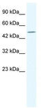 Transmembrane Phosphatase With Tensin Homology antibody, TA341721, Origene, Western Blot image 