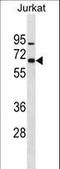 Zinc Finger Protein 358 antibody, LS-C157056, Lifespan Biosciences, Western Blot image 