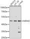 E3 ubiquitin-protein ligase Mdm2 antibody, 13-148, ProSci, Western Blot image 