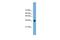 Frizzled Related Protein antibody, PA5-44188, Invitrogen Antibodies, Western Blot image 