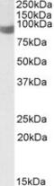 Phospholipase A2 Group IVA antibody, MBS422392, MyBioSource, Western Blot image 