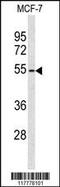 ADAM Like Decysin 1 antibody, 63-787, ProSci, Western Blot image 