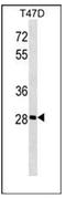 Glycerol Kinase 5 antibody, AP51845PU-N, Origene, Western Blot image 