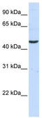 Kynurenine Aminotransferase 3 antibody, TA345719, Origene, Western Blot image 