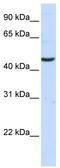 Kynurenine Aminotransferase 3 antibody, TA345719, Origene, Western Blot image 