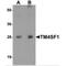 Transmembrane 4 L Six Family Member 1 antibody, TA319680, Origene, Western Blot image 