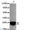 Thiol:disulfide interchange protein DsbA antibody, LS-C812369, Lifespan Biosciences, Western Blot image 