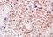 NADH:Ubiquinone Oxidoreductase Core Subunit S7 antibody, orb157939, Biorbyt, Immunohistochemistry paraffin image 