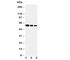 Alpha 2-HS Glycoprotein antibody, R30491, NSJ Bioreagents, Western Blot image 