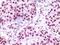 Lysine Demethylase 1A antibody, 32-188, ProSci, Immunohistochemistry frozen image 