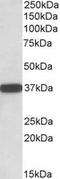 Cytochrome B5 Reductase 3 antibody, LS-B9227, Lifespan Biosciences, Western Blot image 