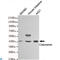 Calumenin antibody, LS-C812899, Lifespan Biosciences, Western Blot image 