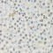 Cyclin Dependent Kinase 6 antibody, LS-C331529, Lifespan Biosciences, Immunohistochemistry paraffin image 