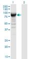 Ribonucleotide Reductase Catalytic Subunit M1 antibody, H00006240-M05, Novus Biologicals, Western Blot image 