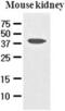 Apoptosis And Caspase Activation Inhibitor antibody, GTX50039, GeneTex, Western Blot image 
