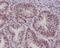 Pygopus Family PHD Finger 2 antibody, M05260, Boster Biological Technology, Immunohistochemistry paraffin image 