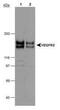 Kinesin-like protein KIF2A antibody, PA3-16624, Invitrogen Antibodies, Western Blot image 