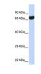 Transmembrane Phosphatase With Tensin Homology antibody, NBP1-58240, Novus Biologicals, Western Blot image 