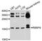 RB Binding Protein 9, Serine Hydrolase antibody, A4451, ABclonal Technology, Western Blot image 