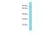 TBC1 Domain Family Member 17 antibody, PA5-70937, Invitrogen Antibodies, Western Blot image 