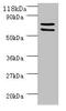 Succinate Dehydrogenase Complex Flavoprotein Subunit A antibody, A51569-100, Epigentek, Western Blot image 