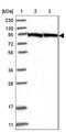 Glycogen Phosphorylase B antibody, NBP2-47446, Novus Biologicals, Western Blot image 