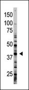G Protein-Coupled Receptor Class C Group 5 Member A antibody, AP13213PU-N, Origene, Western Blot image 