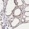 Forkhead Box P2 antibody, NBP1-86672, Novus Biologicals, Immunohistochemistry frozen image 