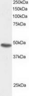 Sorting Nexin 15 antibody, TA302861, Origene, Western Blot image 
