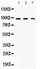 Argonaute RISC Catalytic Component 2 antibody, PB9978, Boster Biological Technology, Western Blot image 