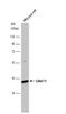 G Protein Subunit Alpha Transducin 1 antibody, NBP2-20696, Novus Biologicals, Western Blot image 